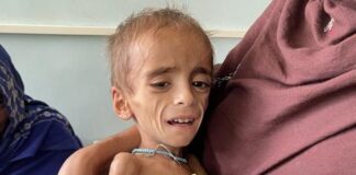 afganistan sağlık kriz açlık
